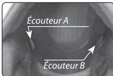 CARDO SCALA RIDER Q2 PRO - Positionnement des écouteurs - 1