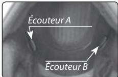 CARDO SCALARIDER Q2 MULTISET PRO - Positionnement des écouteurs - 1