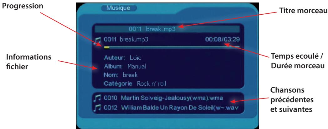VISIONIC VNT 400 - Fonctions de la télécommande pendant la lecture : - 2