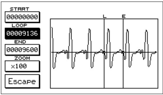 KETRON X8 - Quelques conseils utiles pour la recherche du Loop - 1