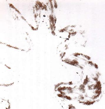 LEWENSTEIN COMPACTA 70E - POSE de dentelle - 4