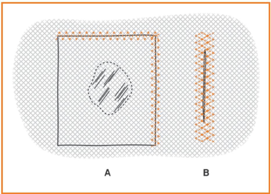 HUSKYSTAR E10 - Rapiéçage : - 4
