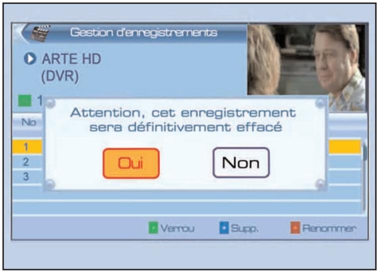 SERVIMAT TNT63HDU - GESTION DES ENREGISTREMENTS (supprimer un enregistrement) - 1
