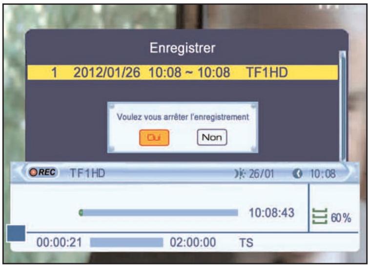 SERVIMAT TNT63HDU - STOPPER UN ENREGISTREMENT - 1