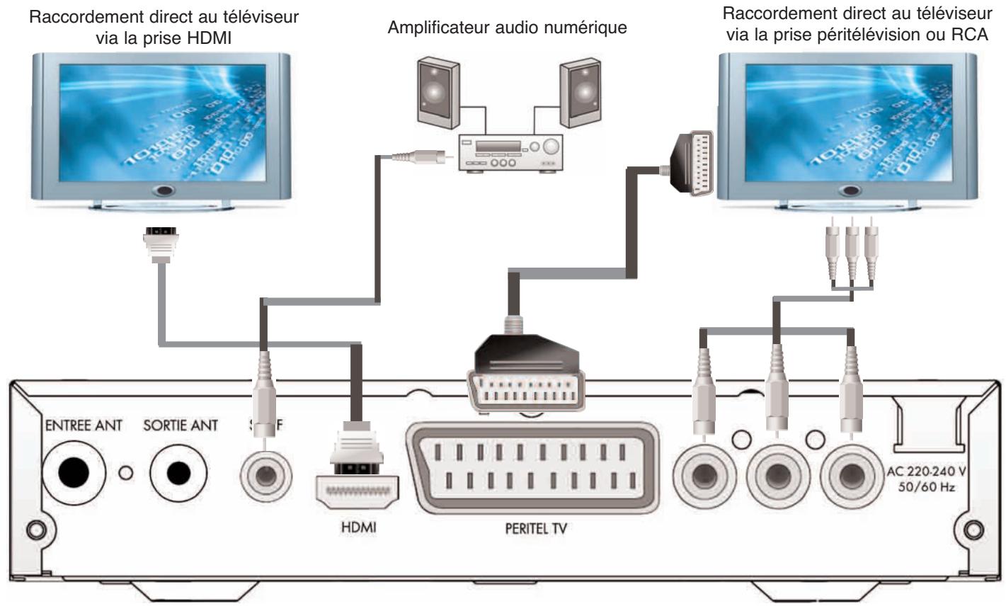 SERVIMAT TNT63HDU - Raccordements audio-video : - 1