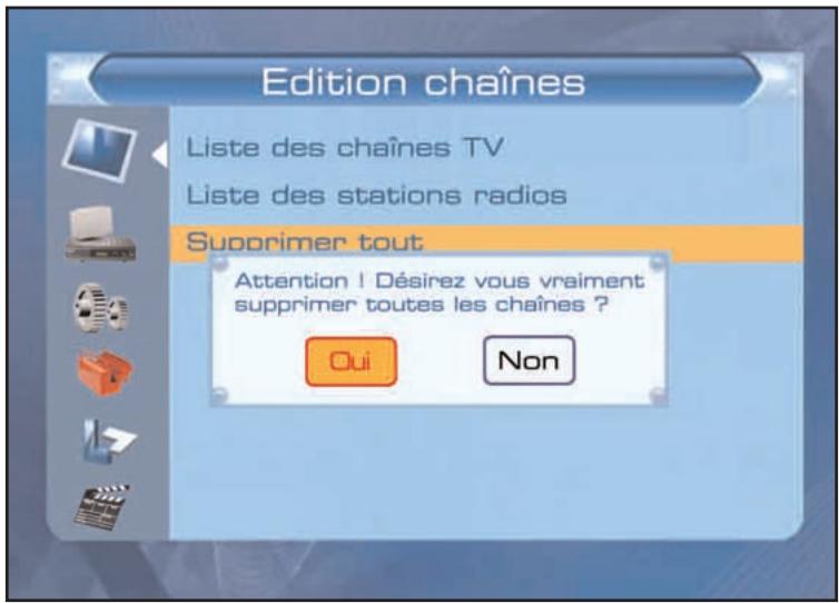 SERVIMAT TNT63HDU - LISTES DES CHAINES (chaines effacées) - 1