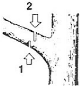 KORMAN GARDEN 1.5 KW - 45.2 CM3 - Elagaged'un arbre - 2