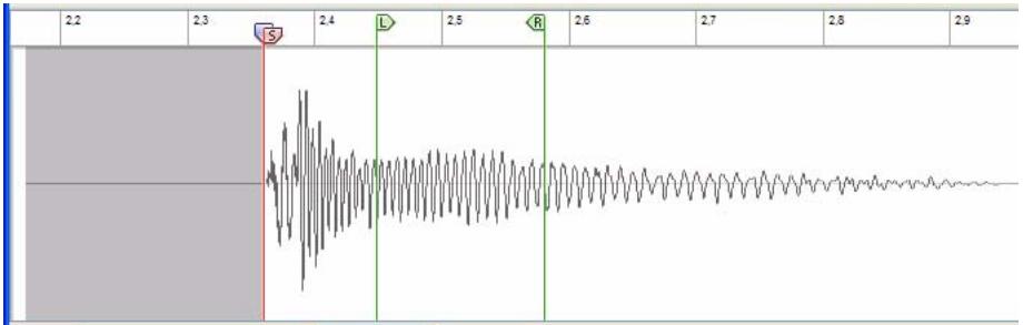 PROPELLERHEAD REASON 5 - Réglage de la position des indicateurs de boucle - 2