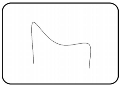 ARC TECHNOLOGY ARC+ 2007 - Retirer des poignées - 2