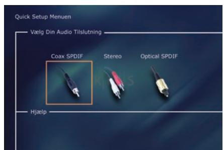KISS DP-450 - skærmbillede: TV - 1