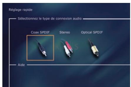 KISS DP-450 - Troisième écran: TV - 1