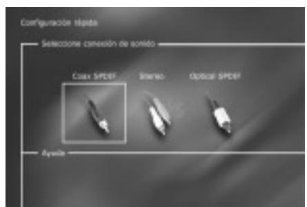 KISS DP-450 - Tercera pantalla: TV - 1