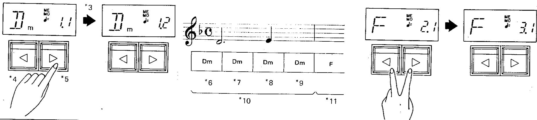 KAWAI X1000 - Procedure - 7