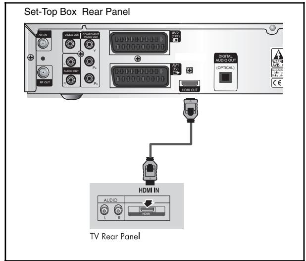 SAMSUNG DCB-H360 - Connecting the Set-Top Box to a TV with a HDMI jack - 1