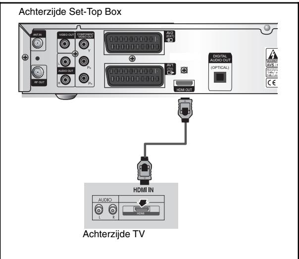 SAMSUNG DCB-H360RA - De Set-Top Box aansluiten op een tv met een HDMI-aansluiting - 1