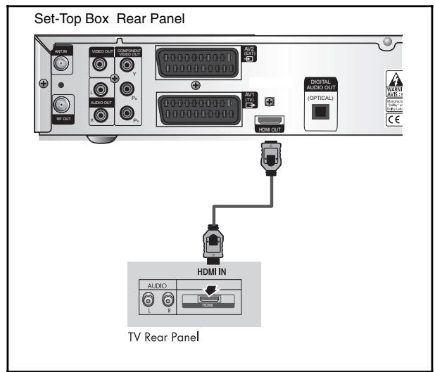 SAMSUNG DCB-H360RA - Connecting the Set-Top Box to a TV with a HDMI jack - 1
