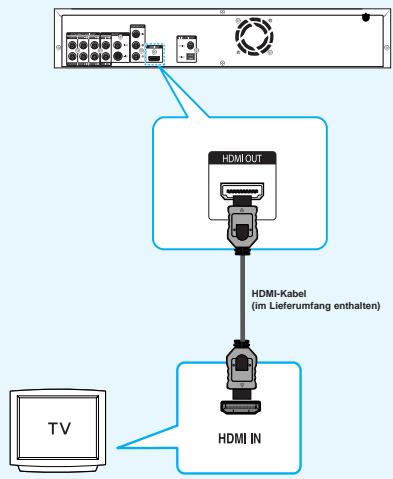 SAMSUNG BD-P1000 - Anschluss an ein Fernsehgerät mit dem HDMI-Kabel - 1