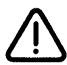 ARTHUR MARTIN TENTATION FE1014 - En cas d'anomalie, que FAIRE? - 1