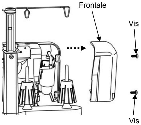 AEG-ELECTROLUX 90S - CHANGEMENT D'AIGUILLE - 3