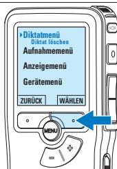 PHILIPS LFH 9375 - Einfugen einer Indexmarkierung - 2