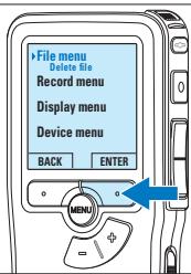 PHILIPS LFH 9375 - Een indexmarkering invoegen - 2