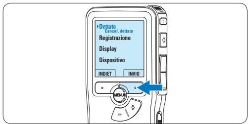 PHILIPS LFH 9375 - Eliminare una segnalazione index - 2