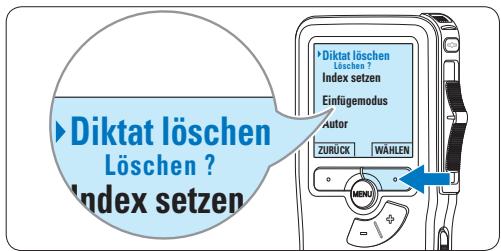 PHILIPS LFH9120,  LFH9120,  LFH9375,  LFH9380,  LFH9398,  LFH9399,  LFH-9172 - Löschen eines Diktats - 3