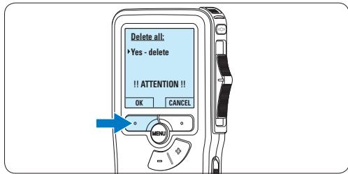 PHILIPS LFH9120,  LFH9120,  LFH9375,  LFH9380,  LFH9398,  LFH9399,  LFH-9172 - Eliminare tutte le segnalazioni index - 3