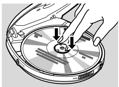 PHILIPS EXP431 - Zubehör - 5
