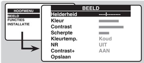 PHILIPS 14PT1521 - Beeldinstallingen - 1
