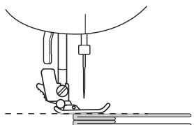 BROTHER FS100WT - Release the presser foot locking pin (black button). - 1