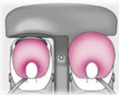 PEUGEOT EXPERT RESTYLE - Les airbags - 1