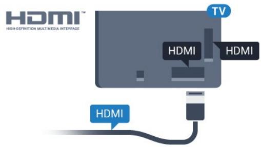 PHILIPS PUH 64000 - Qualité HDMI - 1