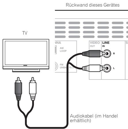 PIONEER X-CM31-N - Hinweis - 1