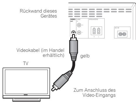 PIONEER X-CM31-N - Hinweis - 1