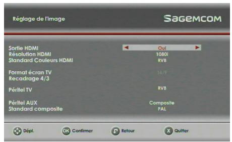 SAGEM DS87 HD,  DS87HD - Sorties en utilisation HD - 1