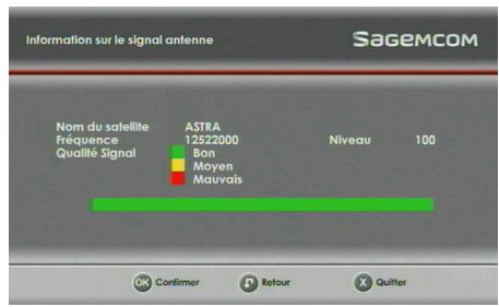 SAGEM DS87 HD,  DS87HD - Installation réseau - 2