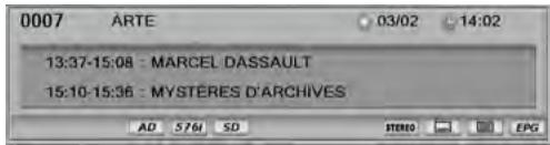 SAGEM DT 84 HD - Afficher le bandeau d'information - 1
