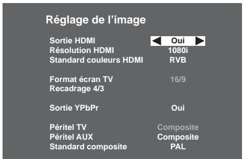 SAGEM DTR 94160S HD - 6-2-1 Sorties en utilisation HD - 2