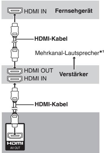 PANASONIC DVD-S54 - Mit HDMI-kompatiblem Fernsehgerät und Verstärker - 1