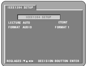 DENON A11 - FORMAT2 - 2