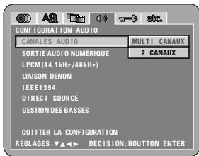 DENON A11 - Gestion des basses - 1