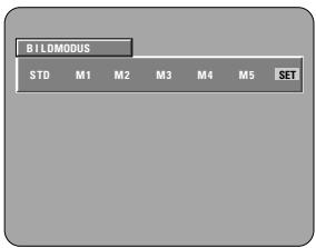 DENON A11 - Beenden der Bildqualitäts-Einstellung - 1