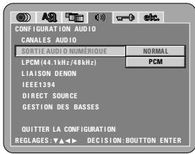DENON A11 - EIN - 5