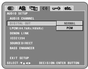 DENON A11 - 2nd - 3