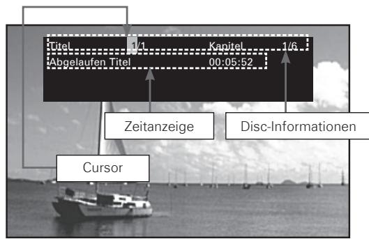 DENON DBP-A100 - Informationsleistenanzeige - 1