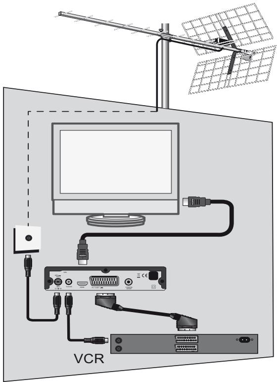 METRONIC ZAPBOX EH-D2 - - Enregistrement sur magnétoscope standard - 1