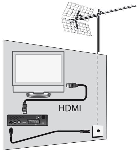 METRONIC ZAPBOX HD-S1 - A-Installazione amplificata - 1