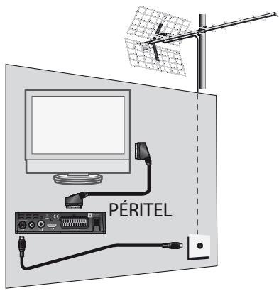 METRONIC ZAPBOX HD-SO.1 - A - Installation simplifiée - 2