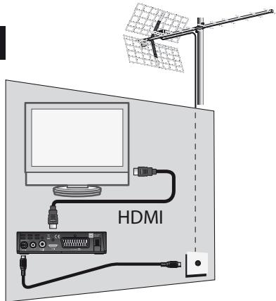 METRONIC ZAPBOX HD-SO.1 - A - Installation simplifiée - 1